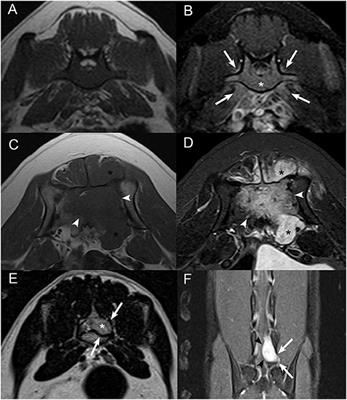 Magnetic Resonance Imaging Features of Extradural Spinal Neoplasia in 60 Dogs and Seven Cats